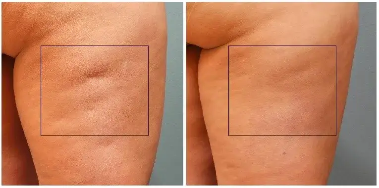 błoto z morza martwego body wrapping efekty